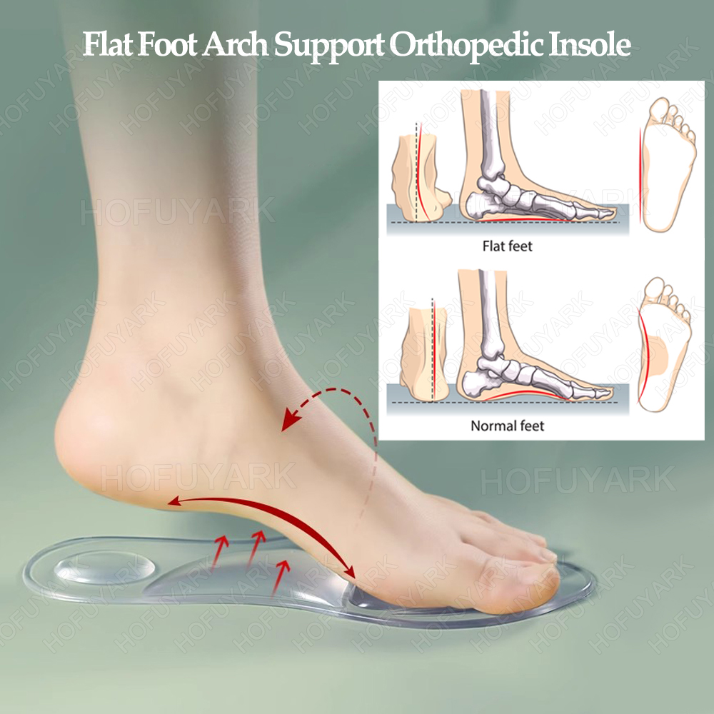 Silicone Gel Insoles Orthopedi - đánh giá và giá Women'S Shoes For Plantar Fasciitis