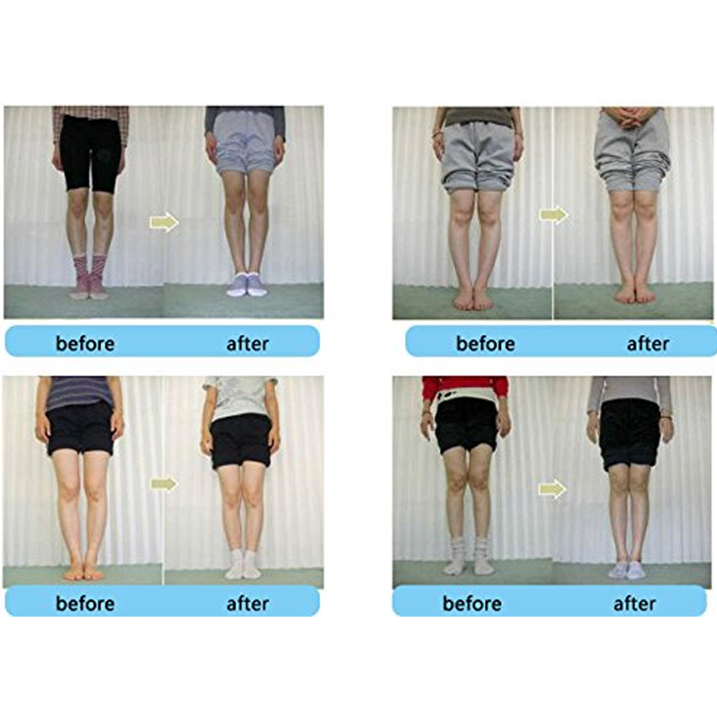 Tcare 1 Chỉnh Hình Miếng Lót C - đánh giá và giá Women Shoes Types